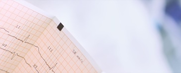 Un ECG da brividi