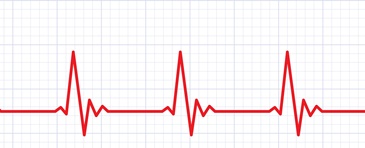 Infarto e trombosi