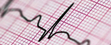 L'ECG nella cardiopatia non ischemica